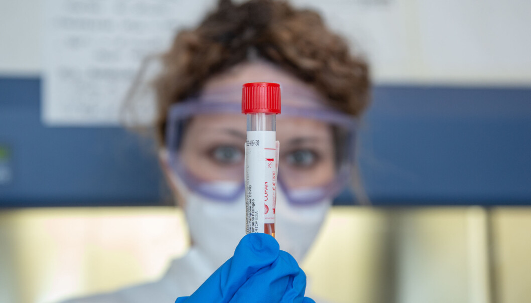 En sykepleier viser fram en vattpinne fra en pasient på et laboratorium ved Universitetet i Roma. Svaret på hvordan pandemien vil påvirke økonomien til universitetene kan det ta flere år å få svar på, sier ekspert som har sjekket økonomien i sektoren. En sykepleier viser fram en vattpinne fra en pasient på et laboratorium ved Universitetet i Roma. Svaret på hvordan pandemien vil påvirke økonomien til universitetene kan det ta flere år å få svar på, sier ekspert som har sjekket økonomien i sektoren.