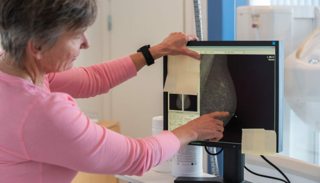 Solveig Hofvind er radiograf og har jobbet med mammografi helt siden Mammografiprogrammet startet i Norge i 1996. Solveig Hofvind er radiograf og har jobbet med mammografi helt siden Mammografiprogrammet startet i Norge i 1996.