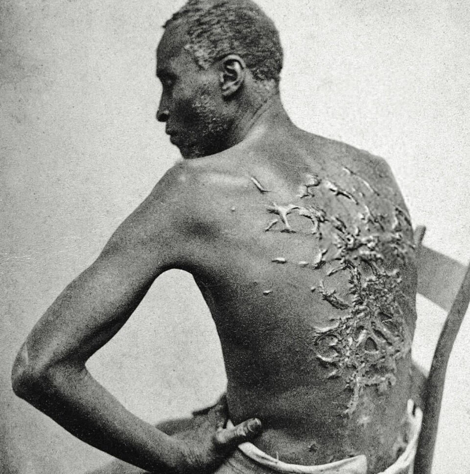 Slaven Gordon klarte å rømme frå ein plantasje i Louisiana. I 1863 vart han kjent då eit bilde vart publisert i Harper's Weekly, det mest leste tidsskriftet under den amerikanske borgarkrigen. I løpet av 1700-talet spelte vitskapen ei sentral rolle i å legitimere slaveriet.
