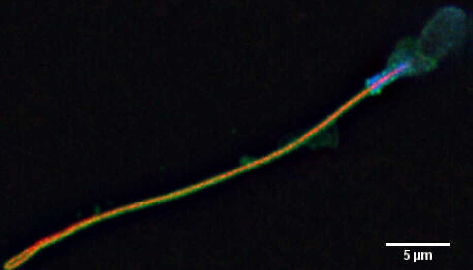 Bilde av sperm tatt i laboratoriet.